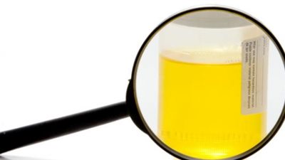 الفرق بين سكر الدم والبول.. متى نجب زيارة الطبيب؟