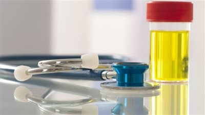 علامات الشفاء من التهاب المسالك البولية.. أفضل مضاد حيوي لعلاج التهاب البول