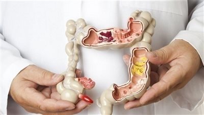 أعراض القولون العصبي النفسية.. 5 علامات انتبه لها واعرف سببها