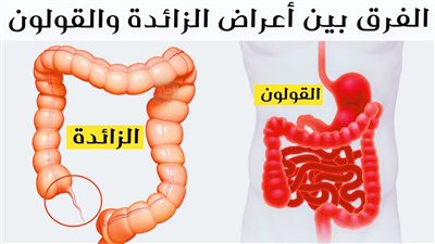ما الفرق بين اعراض الزائدة والقولون؟