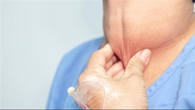 أعراض الغدة الدرقية عند النساء وكيفية التعامل معها.. 18 علامة تحذيرية