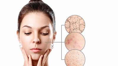 شكل البشرة الجافة في الشتاء.. مواصفاتها وأسبابها وعلاجها