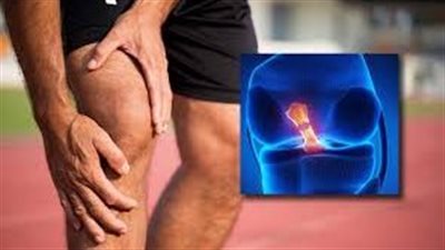 الأعراض والتشخيص والعلاج.. ماذا تعرف عن الرباط الصليبي؟