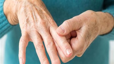  حالة طبية نادرة.. ما هو التهاب العضلات والجلد؟