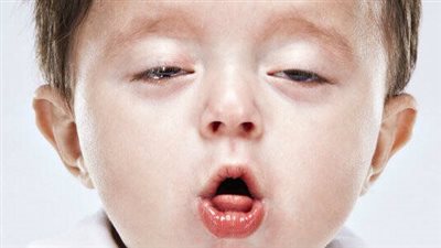  الفرق بين السعال العادي والسعال الديكي.. 4 اختلافات مهمة