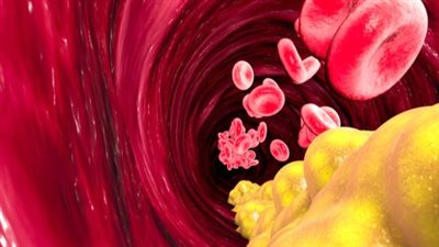 ما هو الكوليسترول الجيد والكوليسترول الضار؟.. اعرف الفرق بينهما