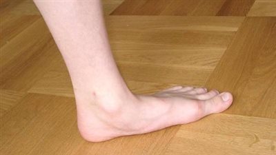 كيف تعود قدميك على الفلات فوت؟.. الأحذية الحل للراحة أثناء المشي