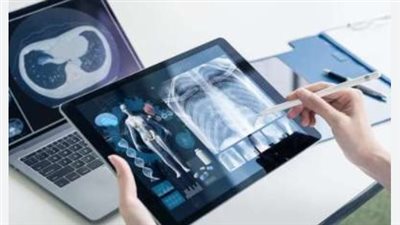  مستشار وزير الصحة للأشعة يكشف تفاصيل تدشين منصة إلكترونية مصرية تحتفظ بأشعة المرضى (فيديو)