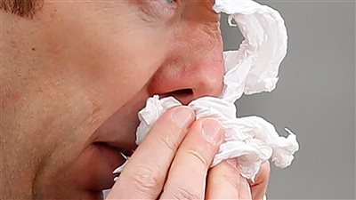 ما هي أعراض التهاب الجيوب الحاد؟