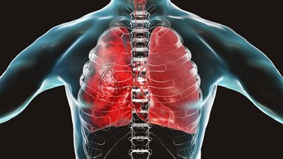 ما الفارق بين التهاب القصبات الهوائية وعدوى الرئة؟