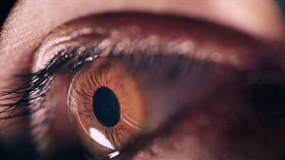 علاج حساسية العين في المنزل.. الكمادات الباردة قد تكون حلا