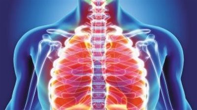 ما هي أعراض التهاب الرغامى الجرثومي البكتيري؟