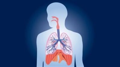 هل هناك طرق أخرى لعلاج التهاب الرغامى الجرثومي البكتيري دون استخدام المضادات الحيوية؟