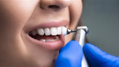 هل يؤلم تركيب الأسنان؟.. لا تخش زيارة الطبيب 