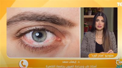 نصائح مهمة لحماية العين من جفاف الشتاء (فيديو)