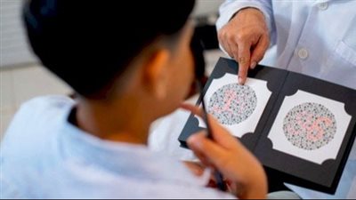 اختبار عمى الألوان.. 3 اختبارات مهمة لتشخيص الإصابة
