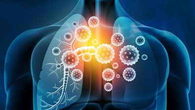 كيف يتم تشخيص التهاب الجهاز التنفسي السفلي؟