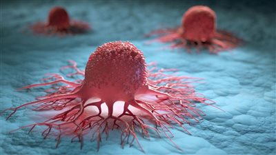 بعد إصابة الملك تشارلز.. ما هي أعراض السرطان المبكرة للرجال والنساء؟