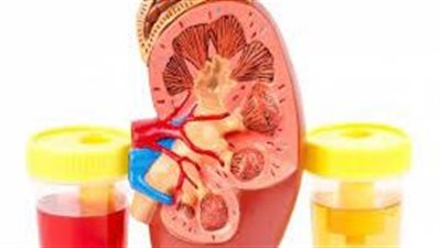 سبب ظهور دم في البول.. قد تكون الأمراض الخبيثة 