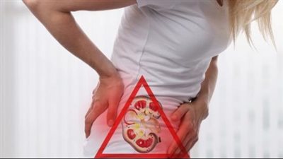 أغذية تفيد مرضى حصوات الكلى.. داوم على البصل والقرنبيط