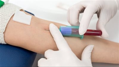 التحاليل المطلوبة لتأخر الحمل للرجال والنساء.. ضرورية جدًا