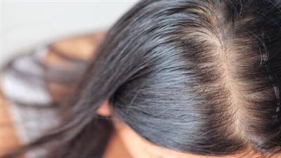 سبب تساقط الشعر عند النساء.. متي يكون خطيرا؟
