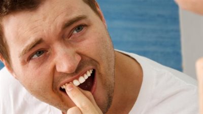 لماذا تتخلخل الأسنان عند الكبار؟.. تعرف على الاسباب وطرق العلاج