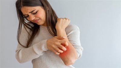 متى تكون الحكة خطيرة.. 5 علامات تدل على وجوب زيارة الطبيب