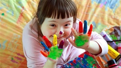 بالتزامن مع اليوم العالمي لمتلازمة داون 2024.. ما هي عوامل الخطر؟