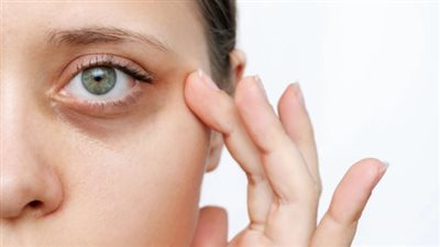 أبرزها وصفة الحلبة والعسل.. أفضل الوصفات التي تساعد على تفتيح الهالات السوداء والتخلص منها