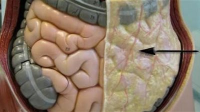 أضرار الدهون الحشوية.. قنبلة موقوتة فى جسمك