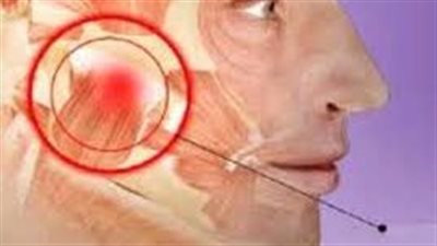 أعراض طقطقة الفك.. صعوبة في تناول الطعام