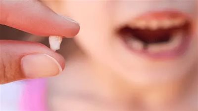 تفسير حلم خلع السن للعزباء ابن سيرين.. دلالات مبشرة للرائية