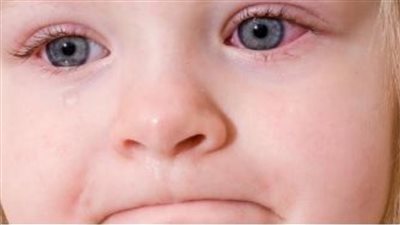 في ظل العواصف الترابية.. تعرف على أعراض الرمد الربيعي عند الأطفال وطرق الوقاية