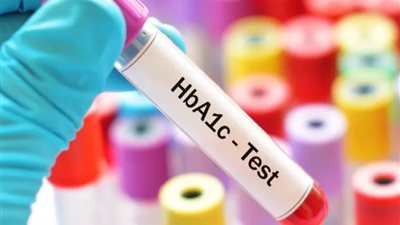 كيف تعرف اصابتك بالسكر دون تحليل؟