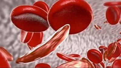  مخاطر تأثير أنيميا البحر المتوسط 