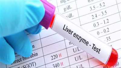 لماذا ترتفع إنزيمات الكبد؟.. الاطباء يقدمون الاجابة