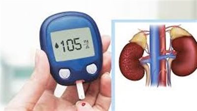 ما علاقة السكر بالفشل الكلوي؟.. ارتباط وثيق