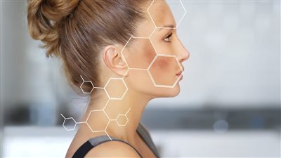 علاج فرط التصبغ.. 3 أسباب رئيسية للإصابة وكريمات موضعية للعلاج