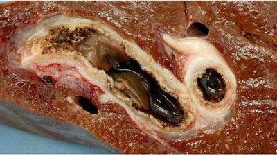 مع اقتراب العيد.. كيف أعرف الكبدة الفاسدة؟