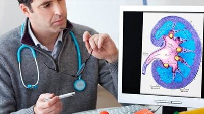 أسباب سرطان الكلى.. 7 أخطاء شائعة في نمط الحياة تجنبها تمامًا