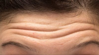 ما سبب الخطوط في الوجه؟.. 6 عوامل محفزة على مقدمات التجاعيد