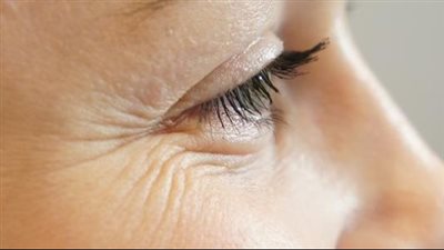 كيف اتخلص من الخطوط الدقيقة؟.. 8 حلول طبيعية وتجميلية لبشرة شبابية