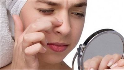 إزالة الرؤوس السوداء في يوم واحد بـ 4 مكونات من الصيدلية