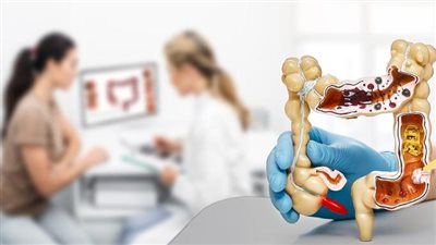 علاج القولون العصبي نهائيا.. الأسباب والأعراض والعلاجات الشائعة