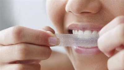 هل لصقات تبييض الأسنان فعالة؟ 