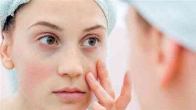 كيفية التخلص من انتفاخ الوجه فى الصباح 