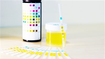 7 من أسباب البول الرغوي.. انتبه لهذه العلامات