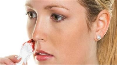 أسباب نزيف الأنف و6 خطوات للسيطرة عليه