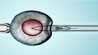 8 معلومات عن التلقيح الصناعي والحقن المجهري.. اعرفي عوامل النجاح